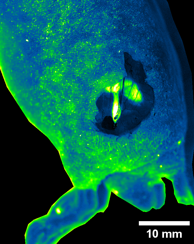 Image guided surgery application