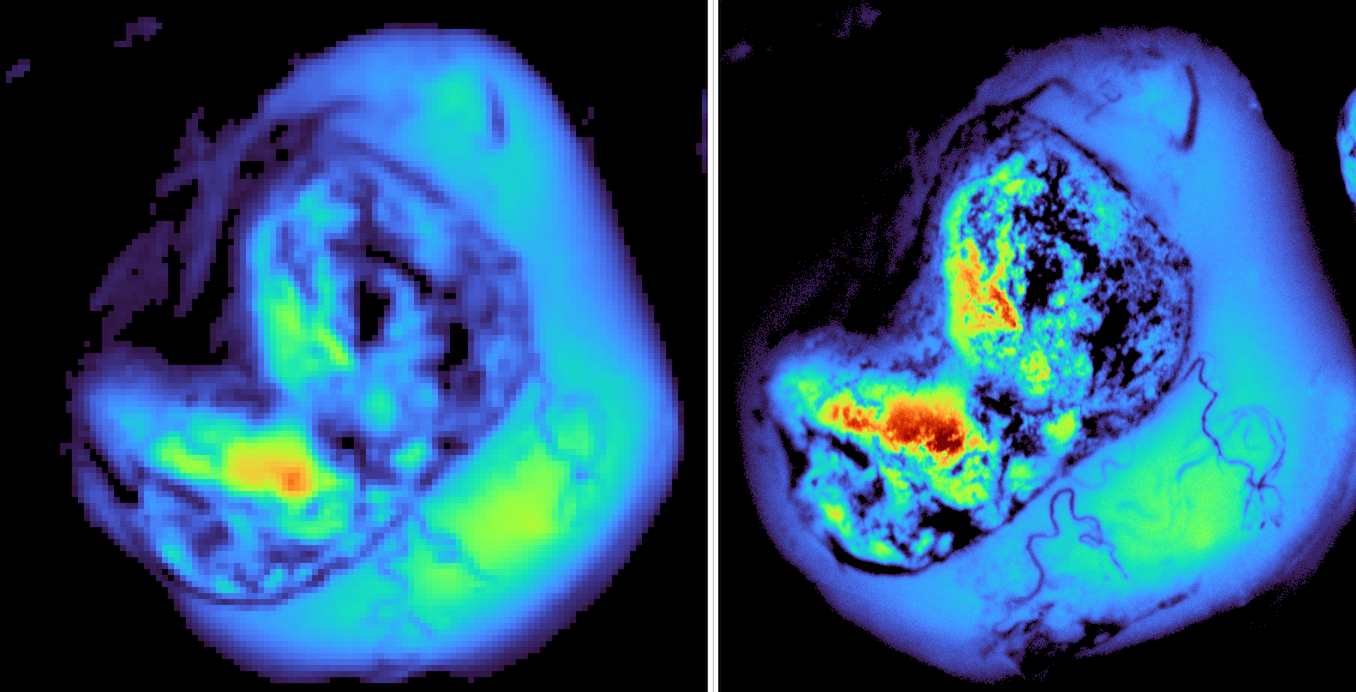 SphynxVision tumor fluorescence image