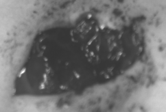 Tumor fragment macro image