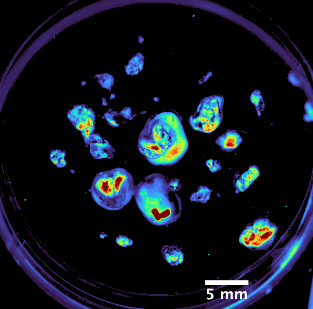 Excised GFP tumor fragments