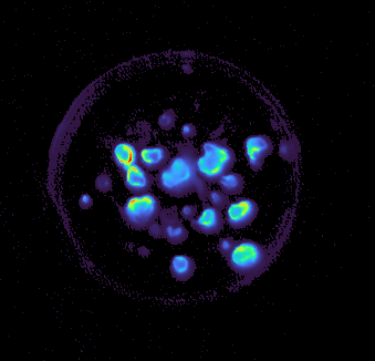 GFP tumor fragment field