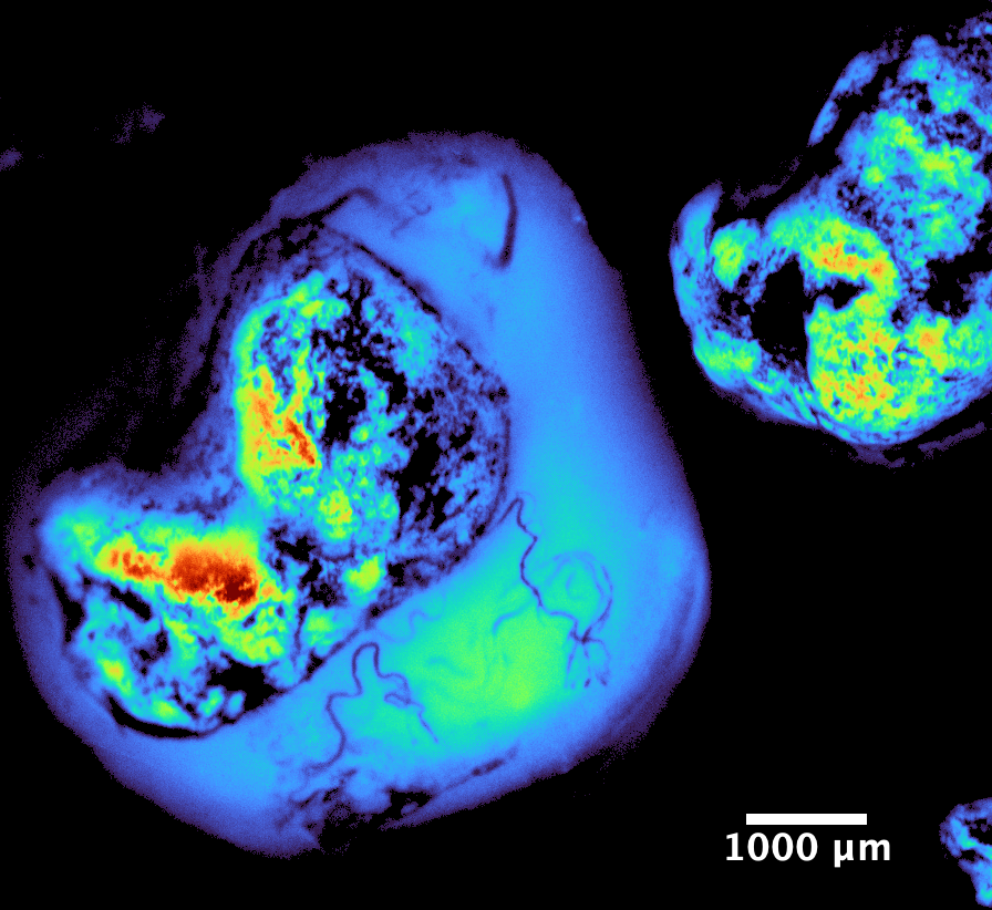 Tumor fluorescence close-up
